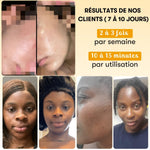 Anti-blemish mask with turmeric