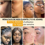 Anti-blemish mask with turmeric